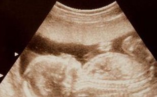 唐山机构做试管医院价格是多少？有详细的成本院介绍