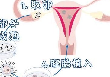 第三代试管助孕费用贵不贵一般多少钱？